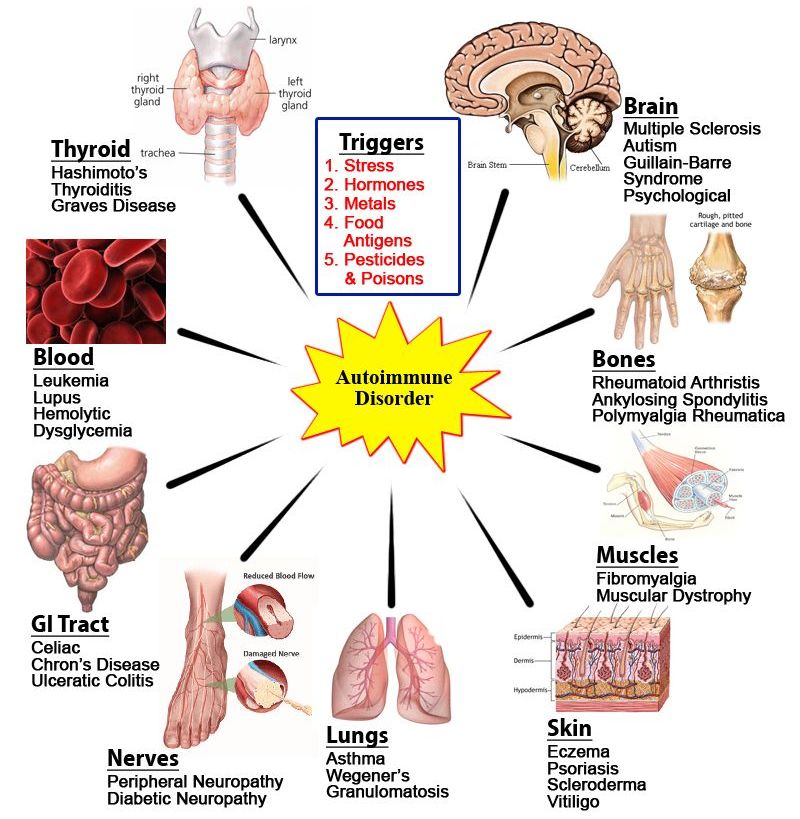 The Autoimmune spectrum can involve any part of the body and be triggered by many causes.